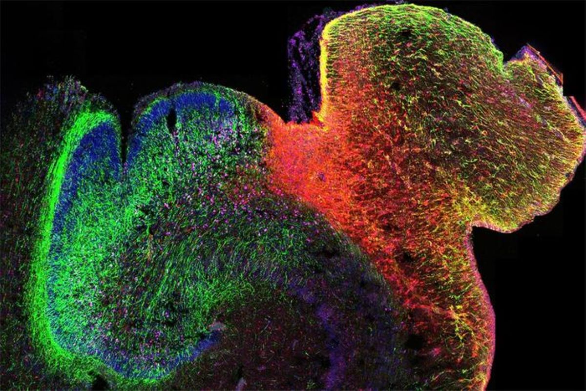 3-D Gene Law Map Sheds Gentle on Mind Construction – Neuroscience Information