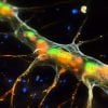 This shows microglia.