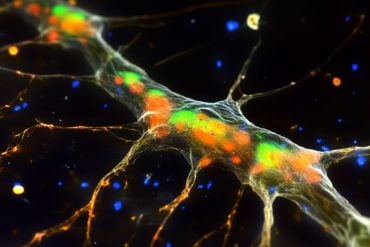 This shows microglia.