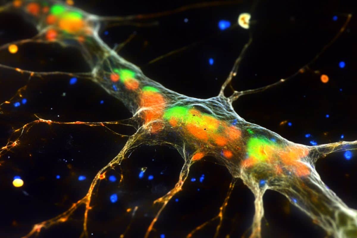 This shows microglia.