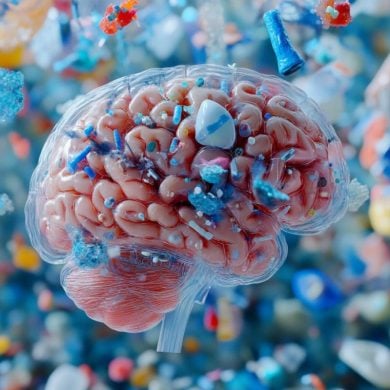 This shows a brain with microplastics.