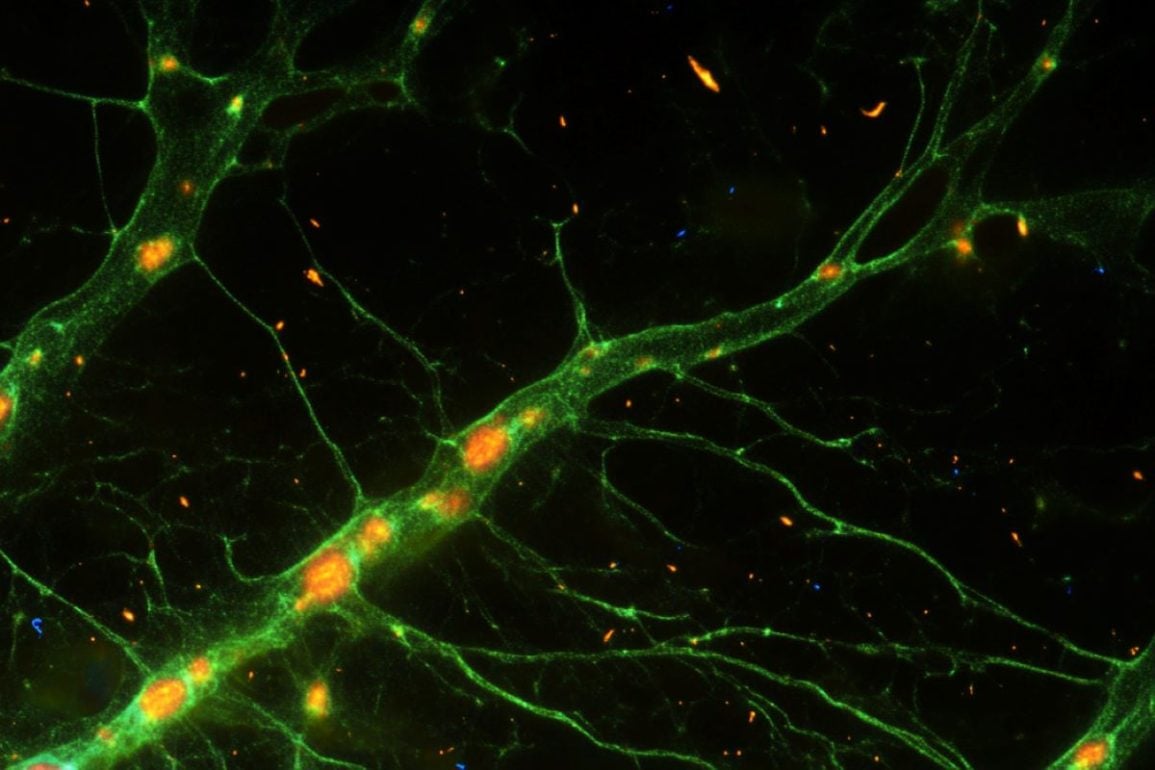 This shows neurons.