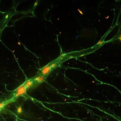 This shows neurons.