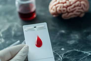 This shows a researcher holding a card with blood on it, a brain is in the background.