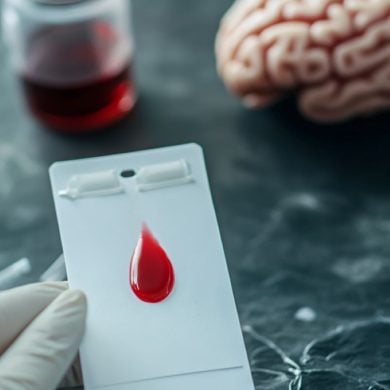 This shows a researcher holding a card with blood on it, a brain is in the background.