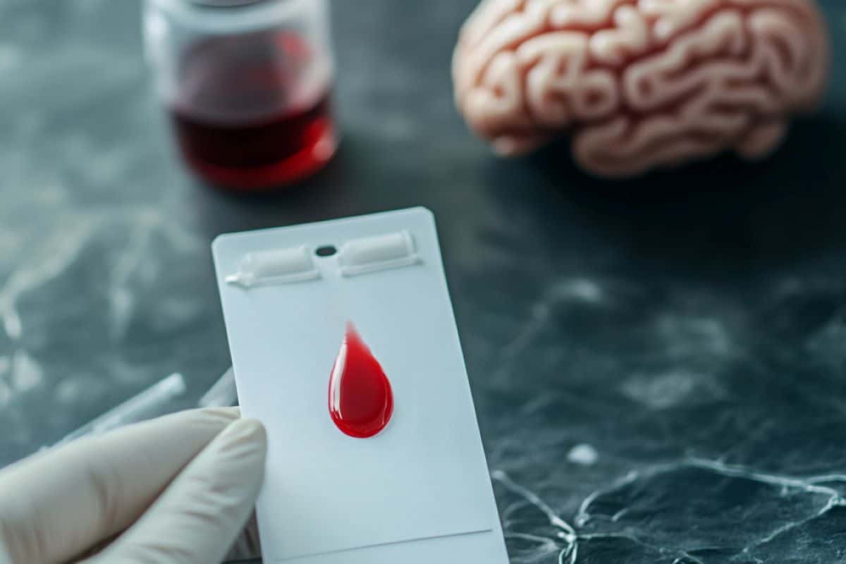 This shows a researcher holding a card with blood on it, a brain is in the background.