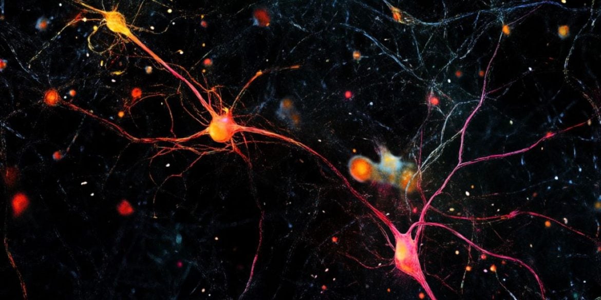 This shows AI generated neurons.