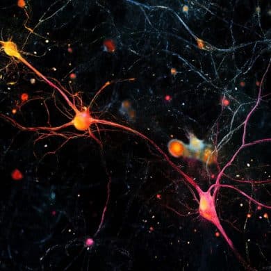 This shows AI generated neurons.