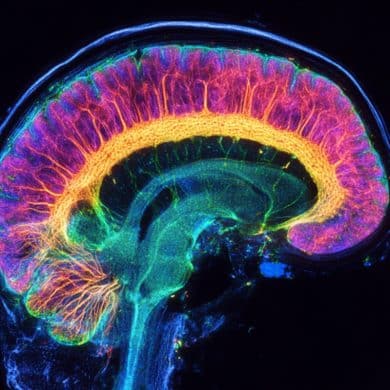 This shows a brainbow.