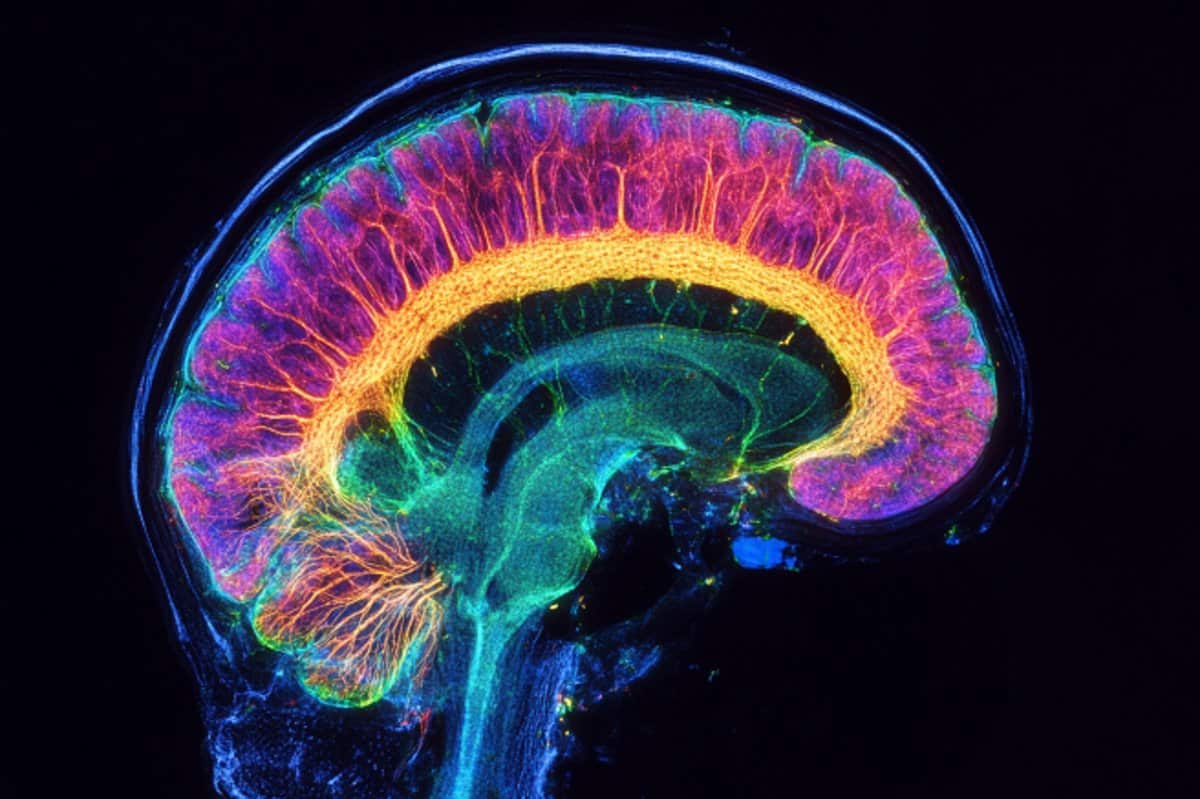 This shows a brainbow.