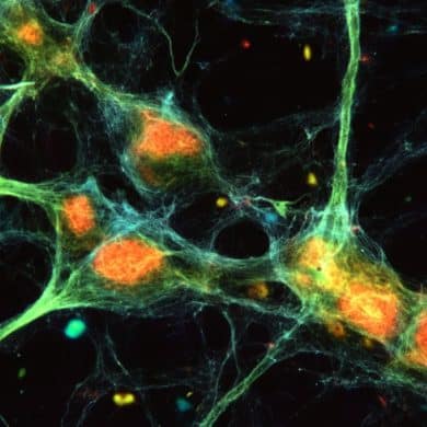 This shows glial cells.