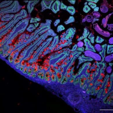 This shows intestinal cells.