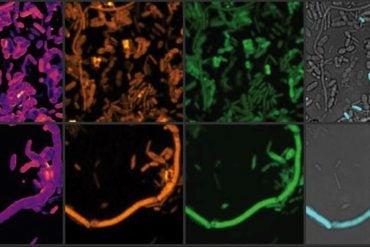 This shows chemical imaging of the microbiome.