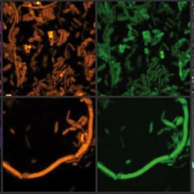 This shows chemical imaging of the microbiome.