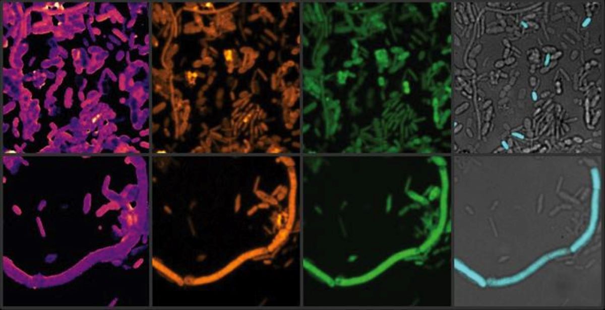 Parkinson’s Drugs Alters Microbiome, Induces Iron Deficiency – Neuroscience Information