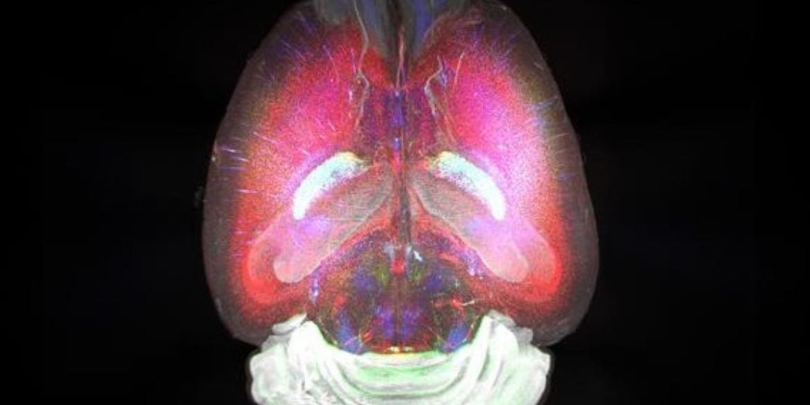 This shows a mouse brain.