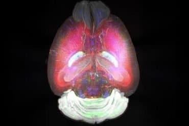 This shows a mouse brain.