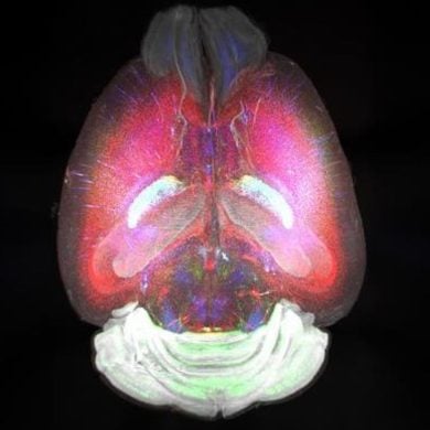 This shows a mouse brain.