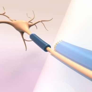 This shows the device around a neuron.