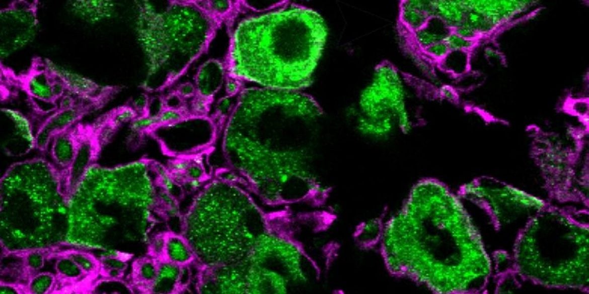 This shows nerve growth factor receptor TrkA.