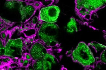 This shows nerve growth factor receptor TrkA.