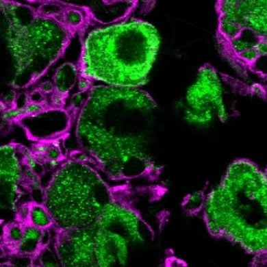 This shows nerve growth factor receptor TrkA.