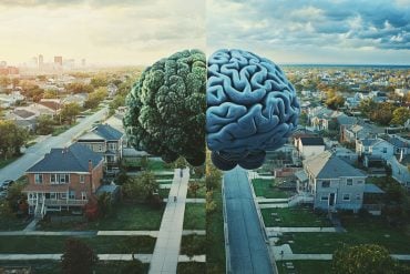 This shows a brain and a street.