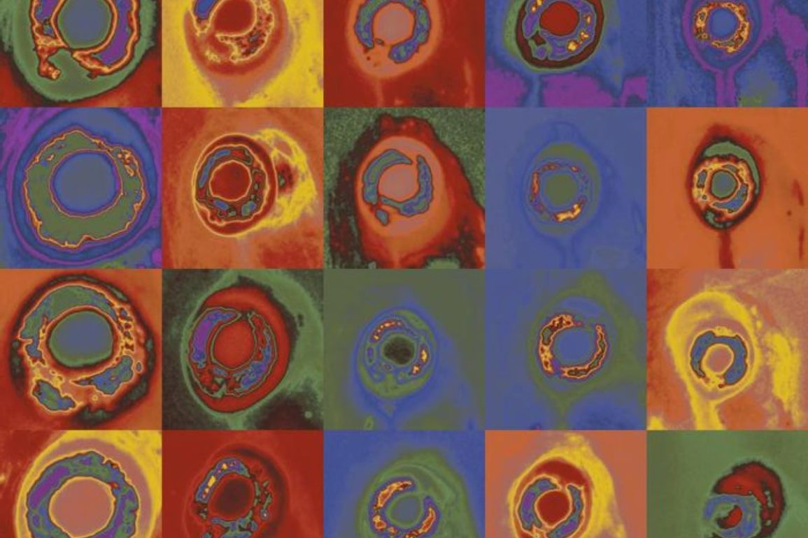 Ancient Brain Reflex Develops Without Sensory Input