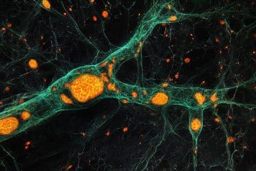 This shows neurons.