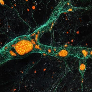 This shows neurons.