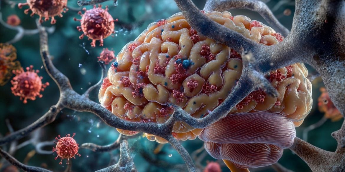 This shows a brain and viruses.