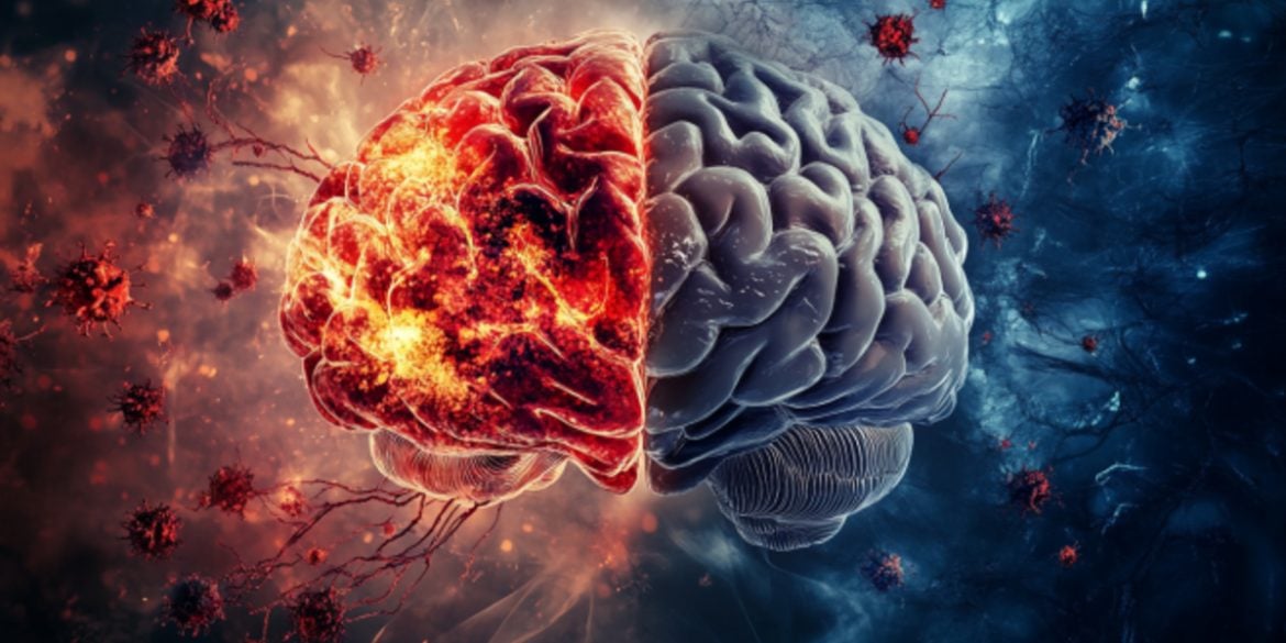 This shows a brain.