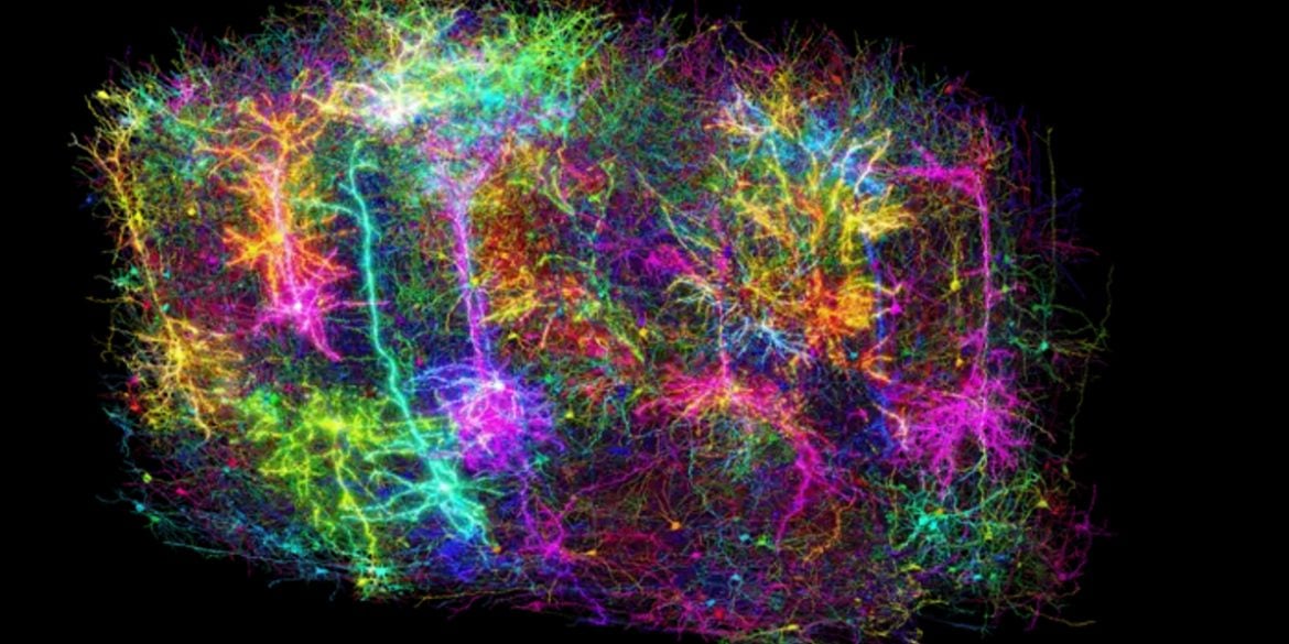 This shows the brain wiring map.