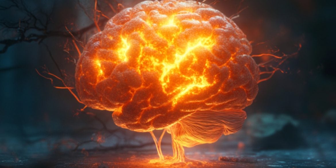 This shows an inflamed brain.