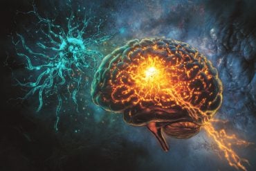 This shows a brain.