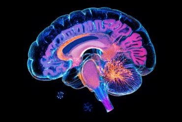 This shows a brain.