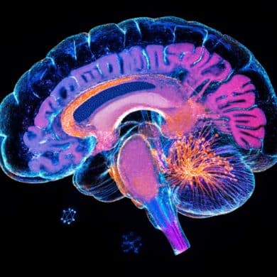 This shows a brain.