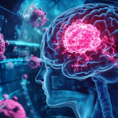 This shows a brain.