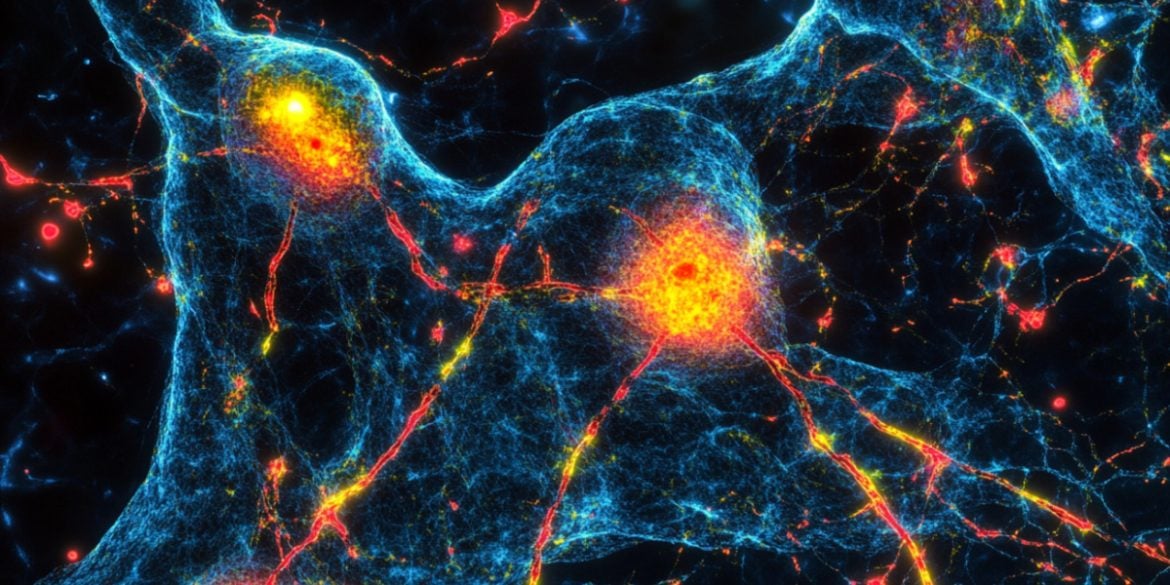This shows neurons.