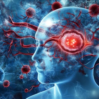 This shows a head.