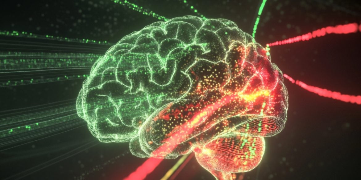 This shows a brain.