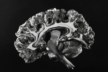 This shows a brain.