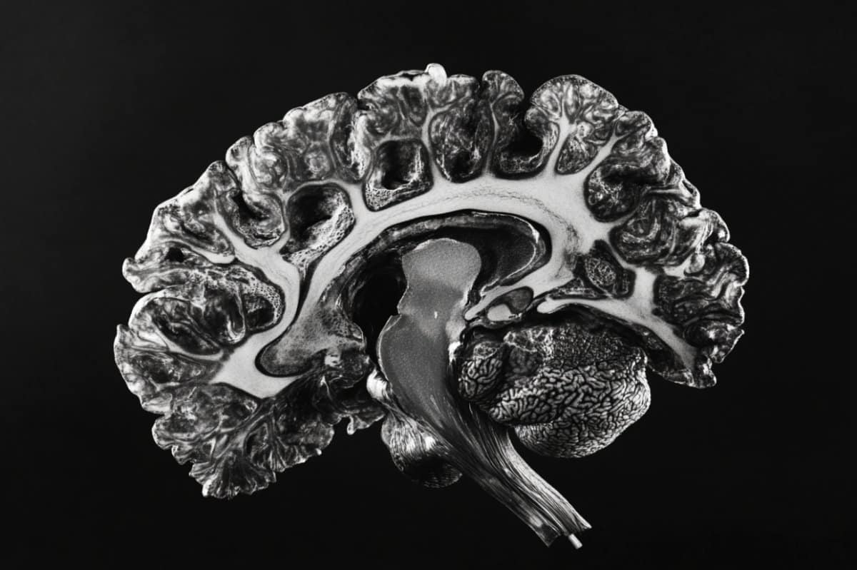 This shows a brain.