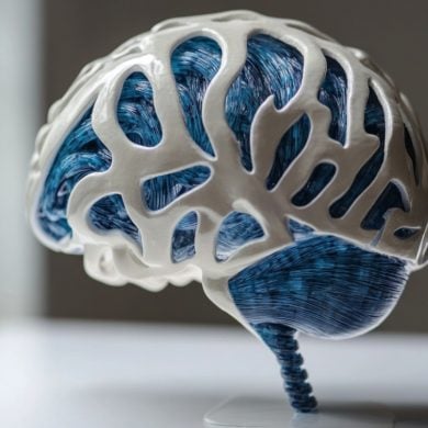 This shows a brain.