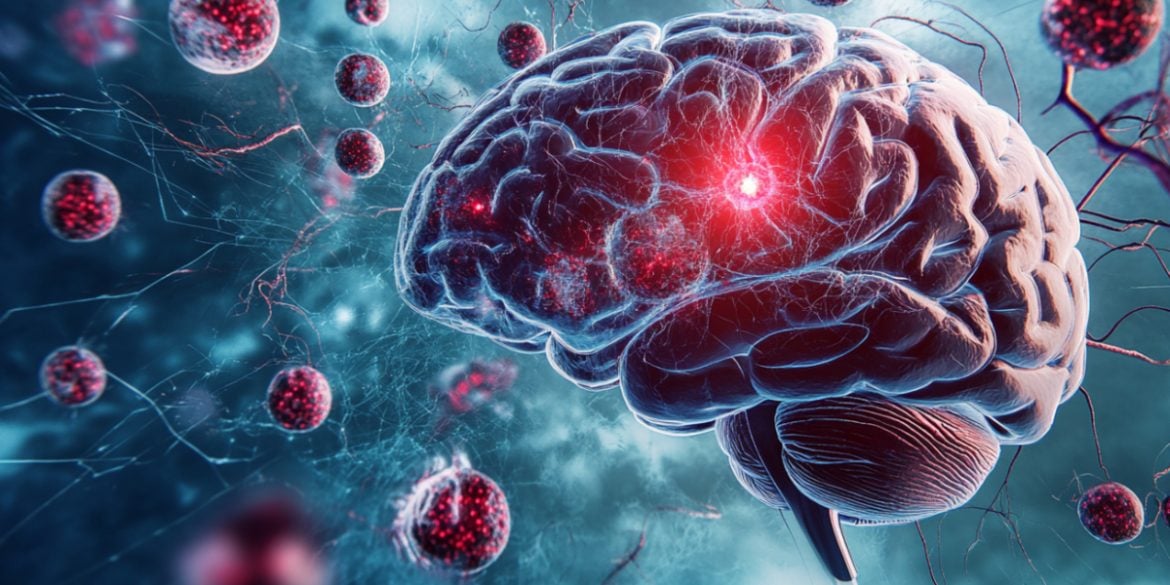 This shows a brain.