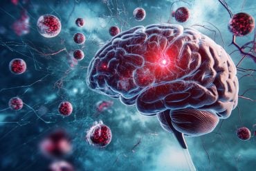 This shows a brain.