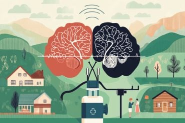 This shows two brains.