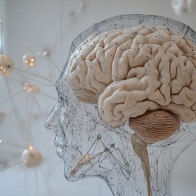 This shows a brain.