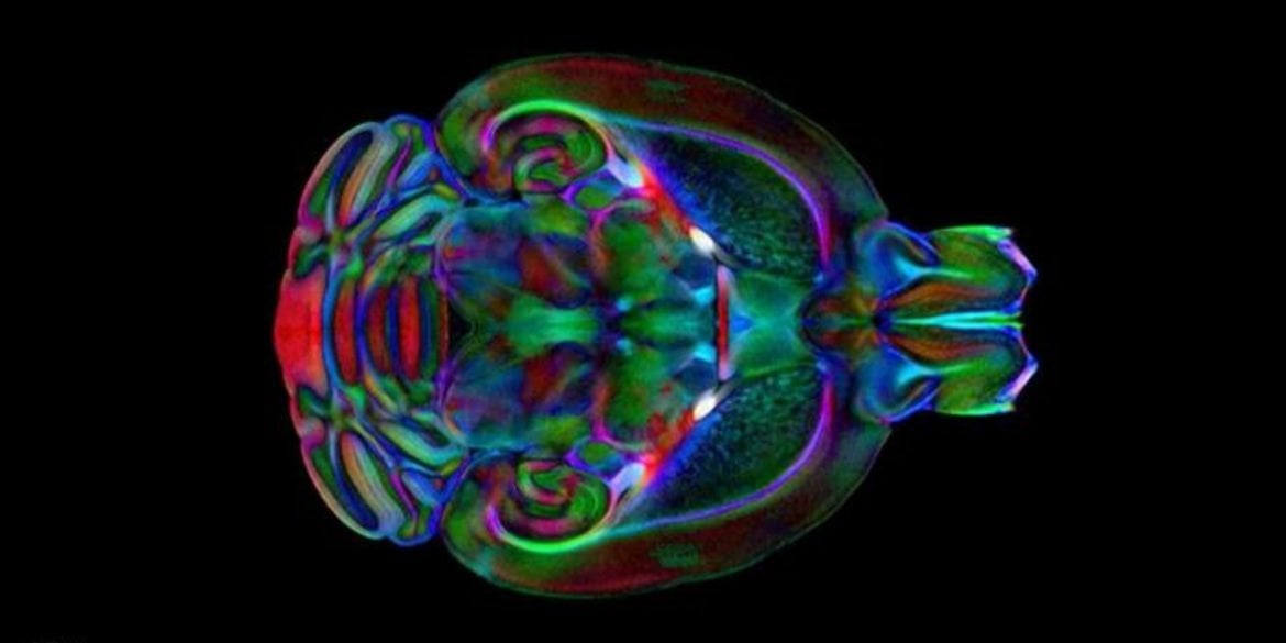 This shows the mouse brain.