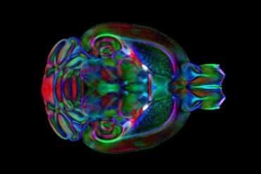 This shows the mouse brain.